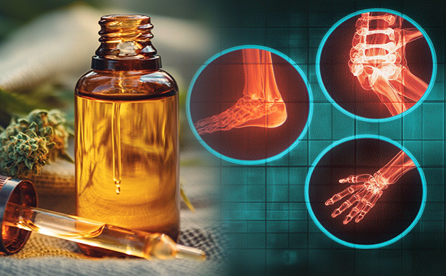 Каннабидиол: безопасное решение для боли?