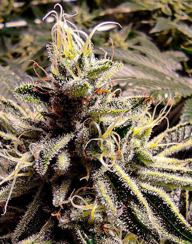 Развитие трихом на 13 ой неделе