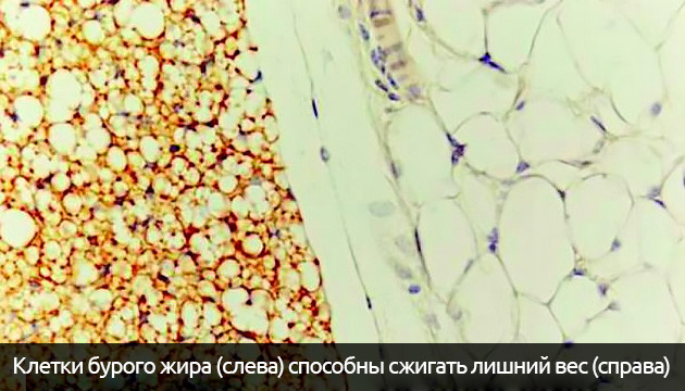 КБД увеличивает количество бурого жира в организме Клетки бурого жира