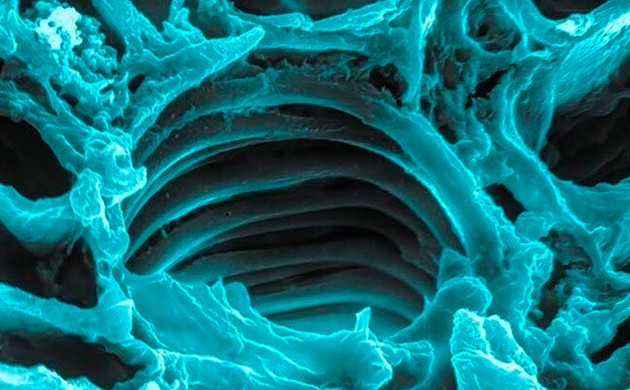 Спиральная клетка под микроскопом